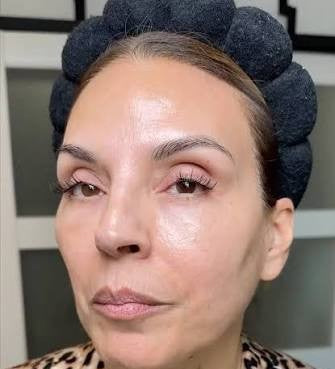 Clienta usando Dr. Melaxin